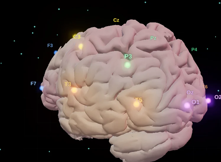 Cérebro em três dimensões com os pontos do neuromapeamento acesos